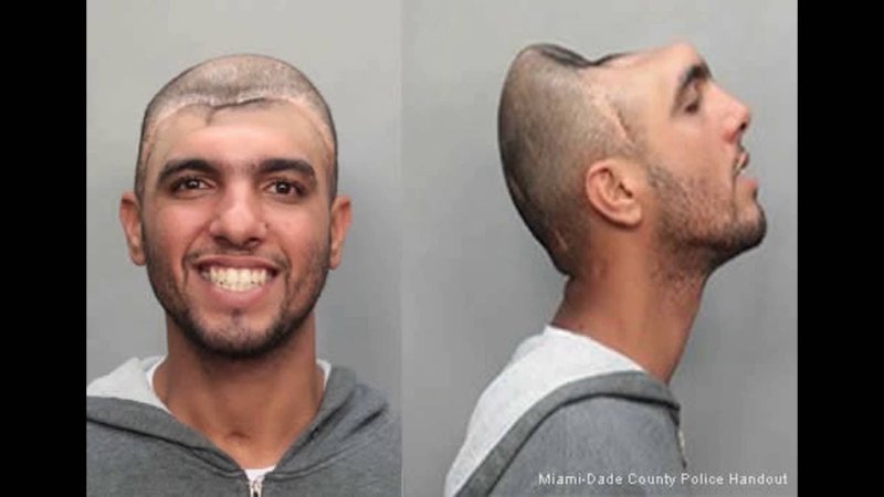 Карлос Родригес без мозга