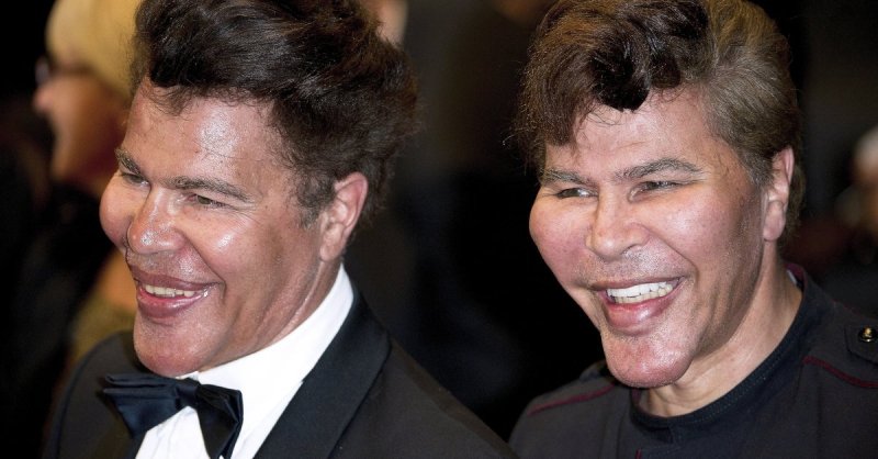 Французские братья Близнецы Богдановы