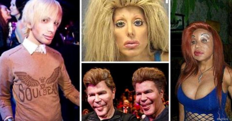 Жертвы пластической хирургии