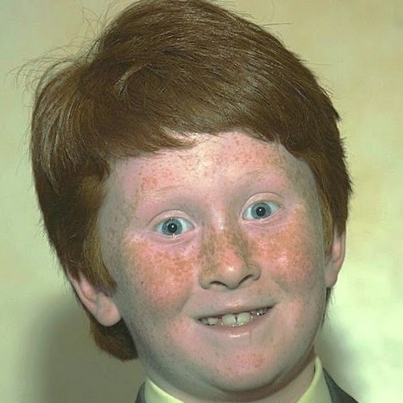 Рыжий парень с маленьким лицом