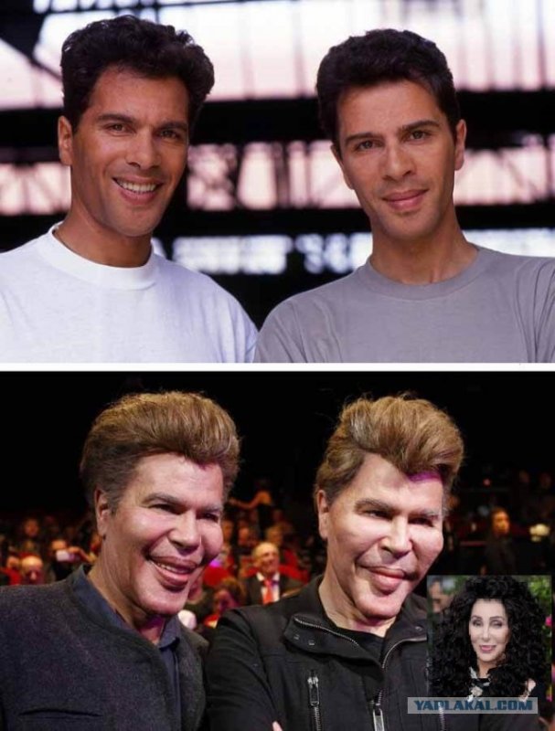 Близнецы Игорь и Григорий Богдановы