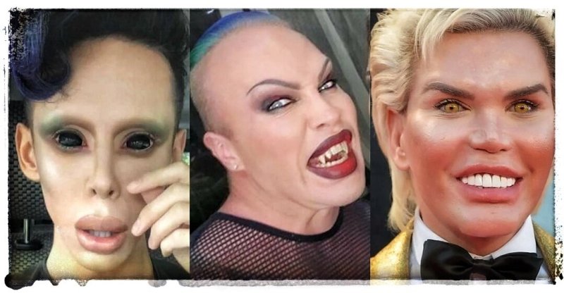 Неудачные пластические операции