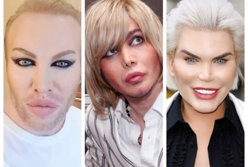 Мужик с накаченными губами и скулами