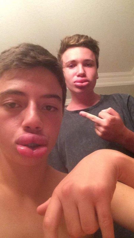 Мальчик с накаченными губами