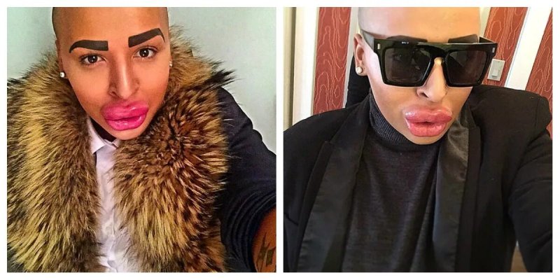 Парень снакачеными губами