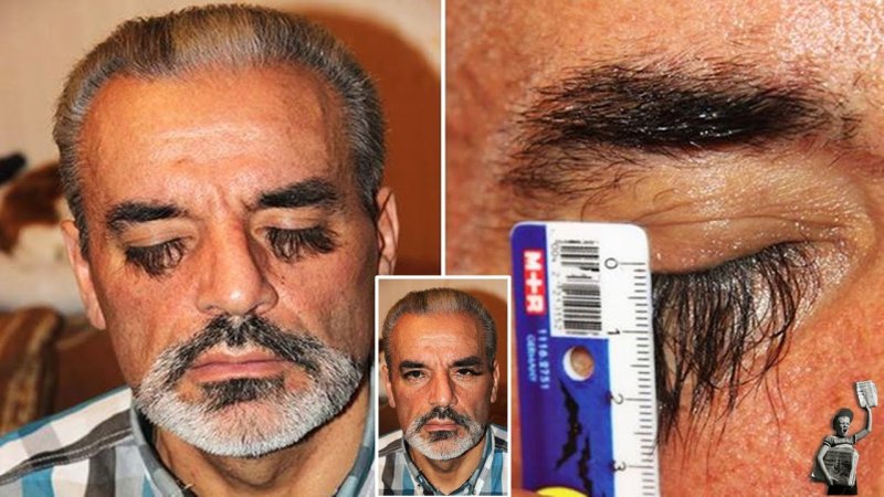 Самые длинные ресницы в мире