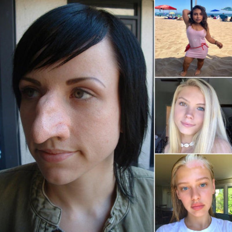 Огромный нос у девушки