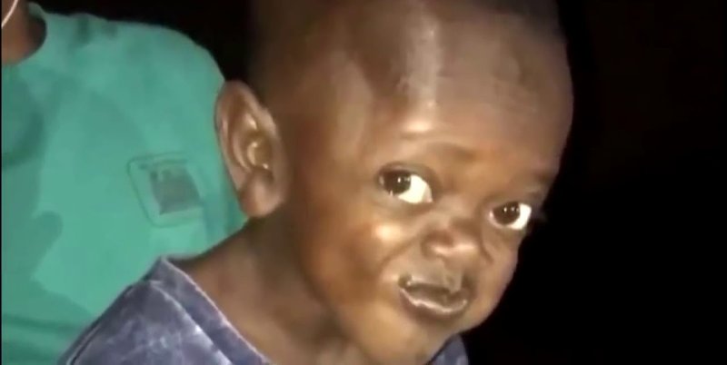 Негр карлик