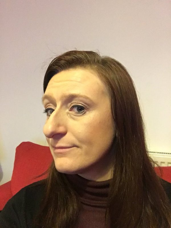 Огромный нос у девушки