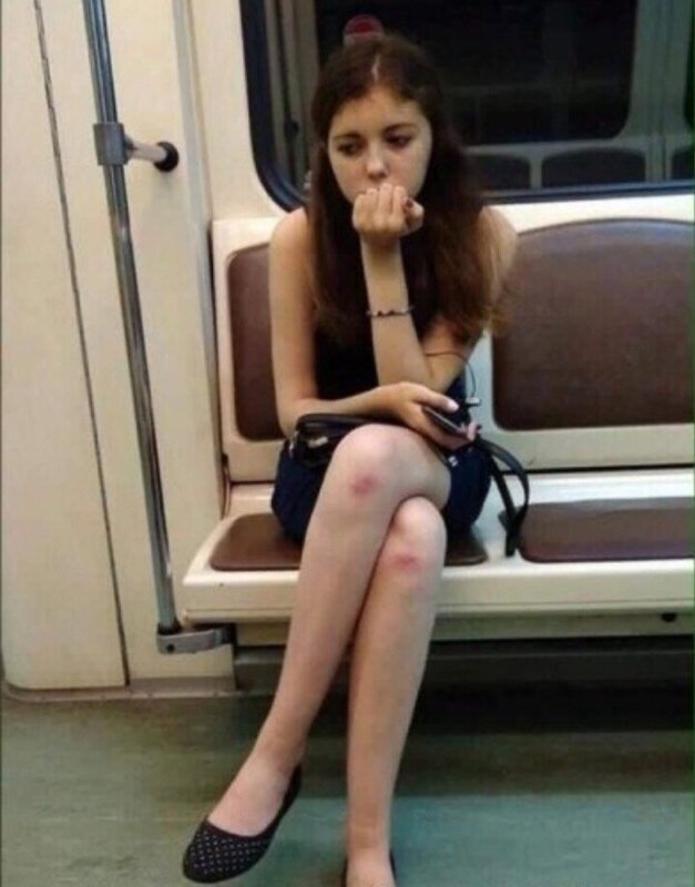 Коленки девушек