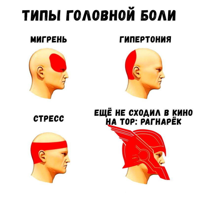 Типы головной боли