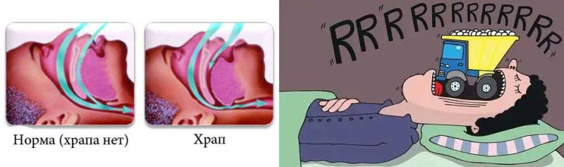Храпеть картинки