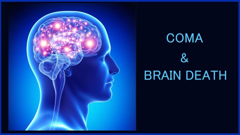 Сверхразум мозг