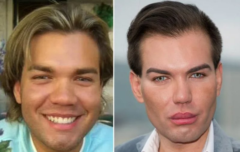 Живой Кен Родриго Алвес до и после пластики