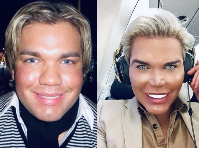 Живой Кен Родриго