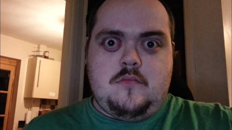 Косоглазый человек