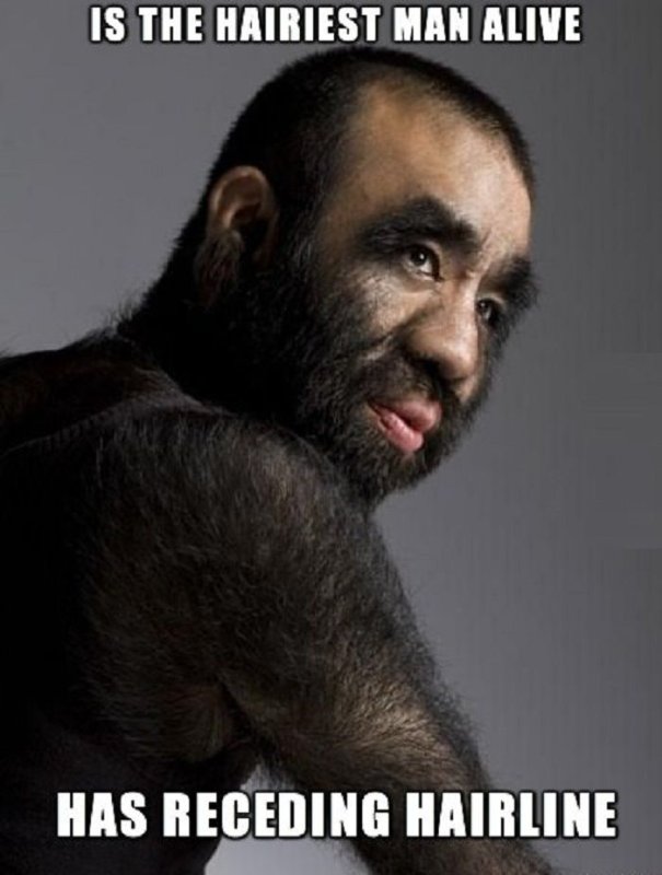 Волосволосатый человек