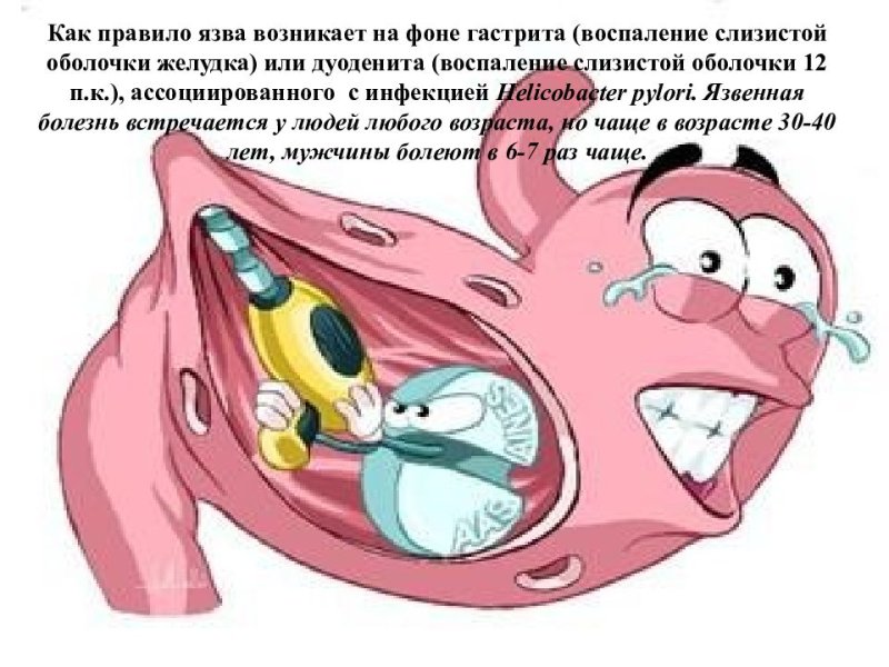 Язва прикол