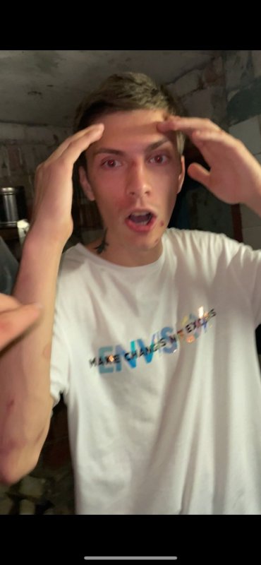 Чел с лицом вытянутым из мема