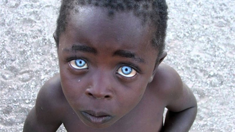 Темнокожий мальчик с голубыми глазами
