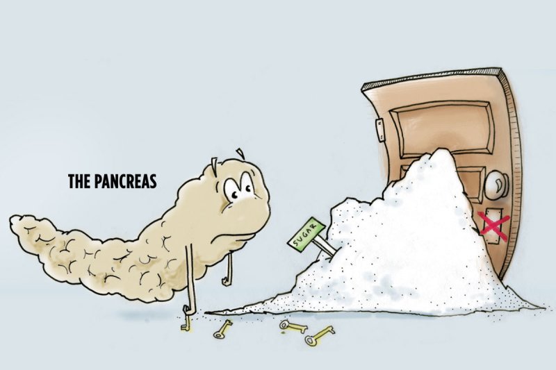 Сахарный диабет иллюстрации