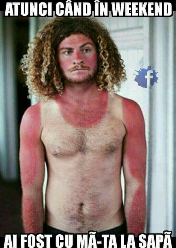 Человек обгорел на солнце