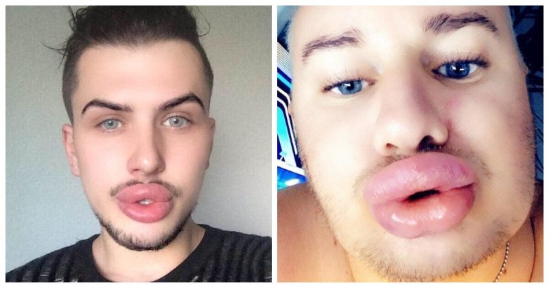 Мужчина с накачанными НУБАМИ