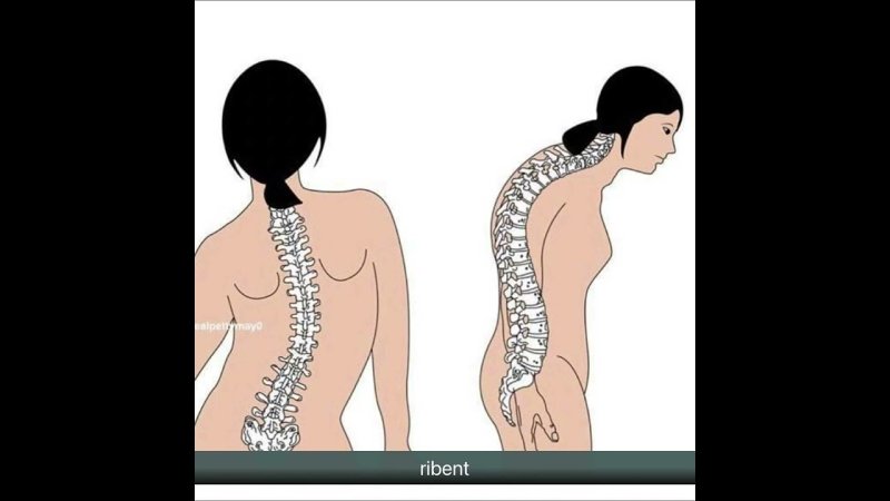 Про выгибание спины девушки